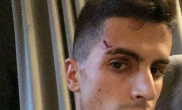El defensa de Manchester City Joao Cancelo víctima de un violento robo en su casa