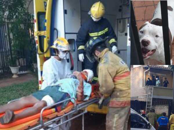Ataque de pitbull deja cuatro heridos en Luque •