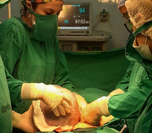 Crónica / ¡Aihue! sacaron masa de ¡6 kilos! del ovario de una doña