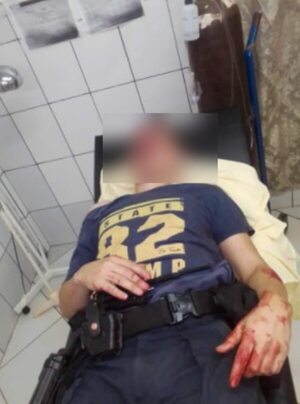 Inadaptados muelen a golpes a policías tras intervenir en caso de polución sonora - Nacionales - ABC Color