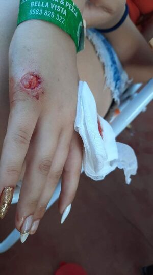 Ataque de pirañitas en playa de Bella Vista causa alarma - Nacionales - ABC Color