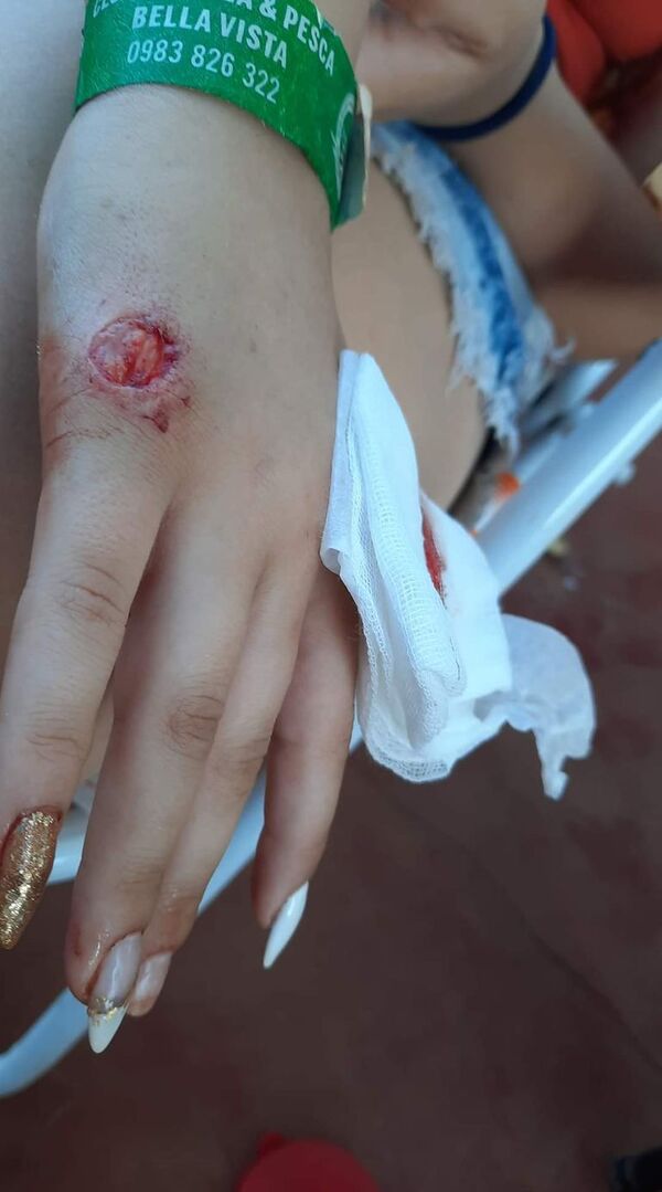 Ataque de pirañitas en playa de Bella Vista causa alarma - Nacionales - ABC Color