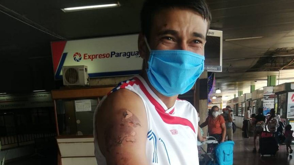 Crónica / (VIDEO) El "Hombre de goma" en la Terminal de Asunción