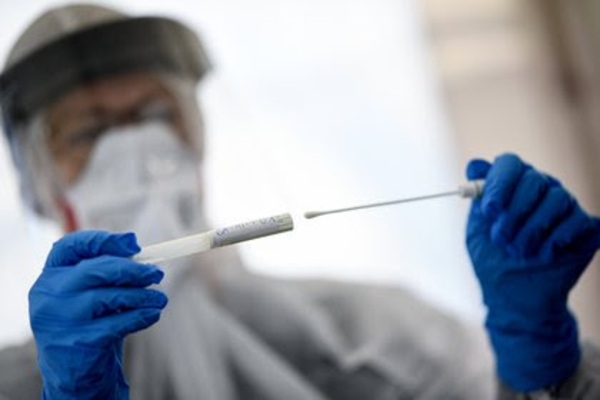 154 con aumento considerable de llamadas por síntomas de coronavirus