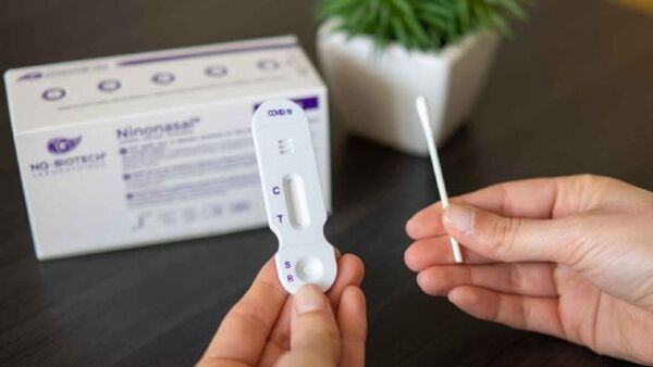 Autotesteos de COVID son inseguros, según dueños de laboratorios: 'Hay una expectativa peligrosa'
