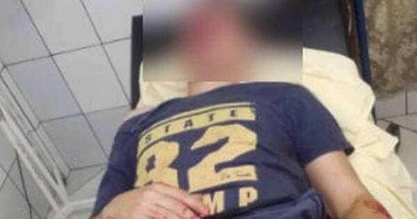 La Nación / Policías reciben brutal golpiza tras intervenir en denuncia por polución sonora