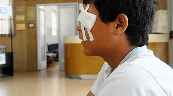 Niño pierde un ojo por jugar con pirotecnia - Noticiero Paraguay