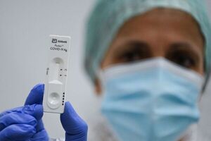 Preocupan la venta libre y el uso del autotest para detectar virus de covid - Nacionales - ABC Color
