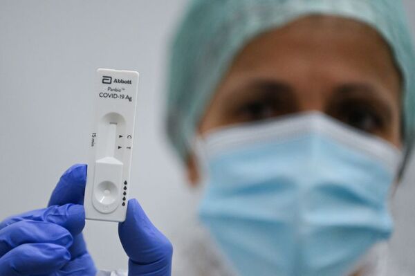 Preocupan la venta libre y el uso del autotest para detectar virus de covid - Nacionales - ABC Color