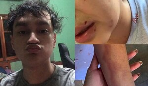 Joven denuncia que fue brutalmente golpeada por su pareja - Noticiero Paraguay