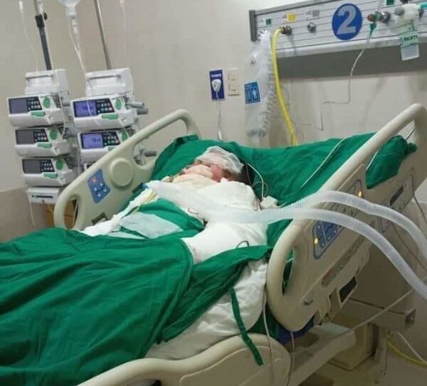 Murió joven quemado por su novia con gasolina