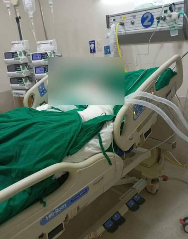 Crónica / Omano anga el joven quemado en confuso episodio