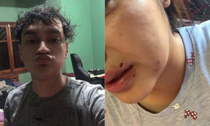 Joven denuncia a hijo de defensora pública por agresión física - OviedoPress