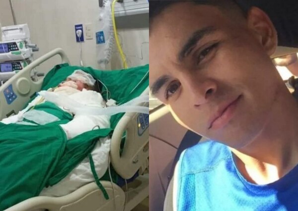 Falleció el joven que fue quemado por su novia - Noticiero Paraguay