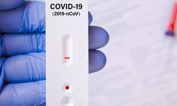 Farmacias ya venden autotest rápido de Covid-19 - C9N