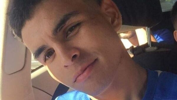 Falleció joven que habría sido quemado por su novia