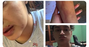 JÓVEN DENUNCIA PÚBLICAMENTE HABER SIDO AGREDIDA POR SU NOVIO - El Observador
