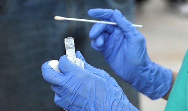 DiNaViSa recomienda los test PCR descartados en gran parte del mundo