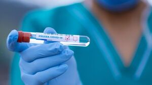 Covid-19: Laboratorios alertan que autotest no servirán para gestiones oficiales