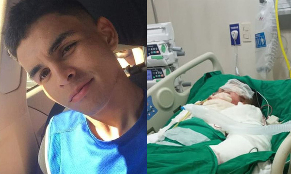 Fallece el joven que habría sido quemado por su novia - OviedoPress