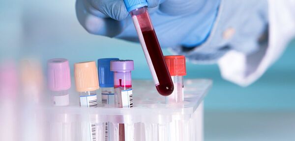 Desarrollan el primer test de sangre capaz de identificar el cáncer y si se ha expandido - Megacadena — Últimas Noticias de Paraguay