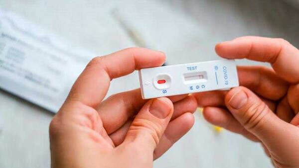 Autotest del COVID sirven especialmente para disminuir la transmisibilidad del virus - Megacadena — Últimas Noticias de Paraguay