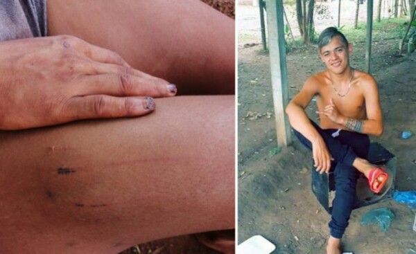 ¡De terror!: Drogadicto torturó y casi mató a su pareja