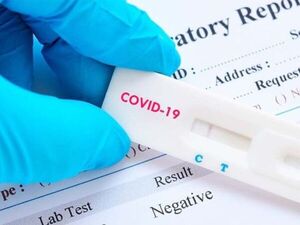 Laboratorios privados continúan campaña contra autotest rápido para detección del covid - ADN Digital