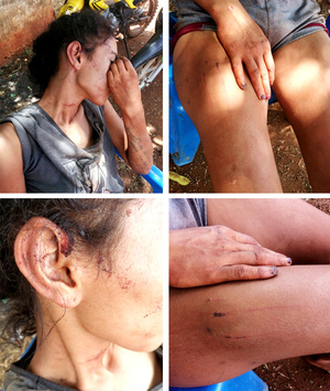 Mujer fue torturada y casi muerta por su pareja, pero la Policía no hizo nada - La Clave