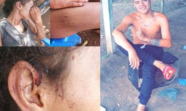 Joven por celos arranca las uñas a su concubina y casi la mata – Diario TNPRESS