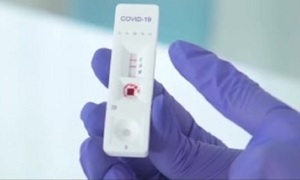 COVID 19: Test rápido anticovid de venta en farmacias - SNT