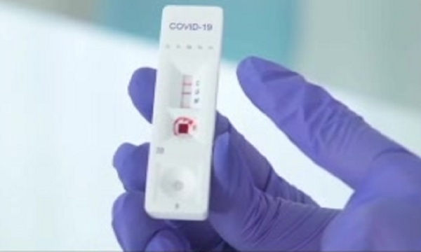 COVID 19: Test rápido anticovid de venta en farmacias - SNT