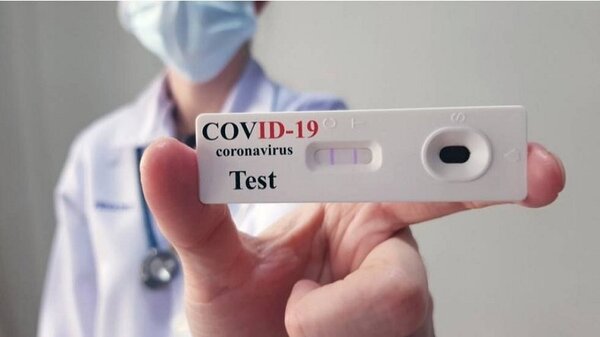 Autotest de covid permitirían tratamientos precoces, asegura médica | Noticias Paraguay