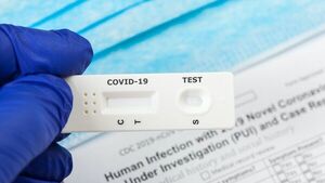 Autotest permitirá tratamiento precoz anti-Covid, sostiene médica