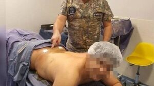 Lipo para hombres es furor: piden bajar la pancita y tener abdominales marcados