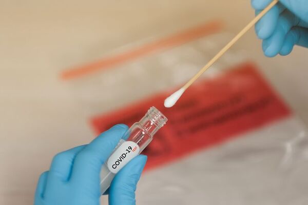 Hisolab IPS continúa realizando toma de muestras, recuerdan - Nacionales - ABC Color