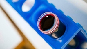 Diario HOY | Sangre falsa para luchar contra los mosquitos y la malaria