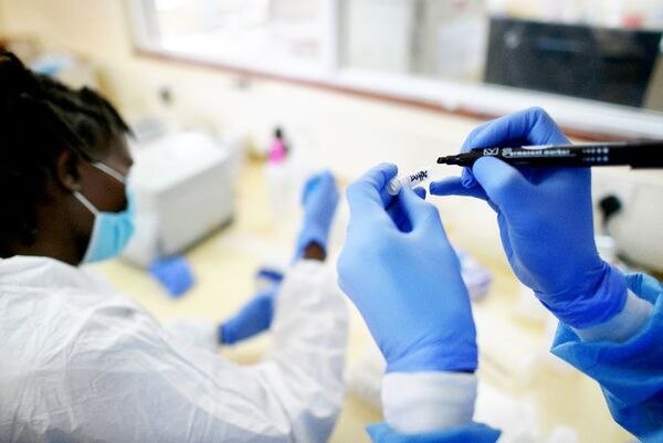 El tratamiento anticovid de Novartis muestra resultados positivos en ensayos - Ciencia - ABC Color