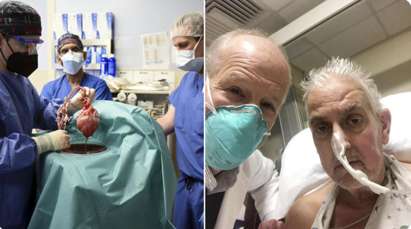 Trasplantan con éxito un corazón de cerdo a una persona en EE.UU. - Noticiero Paraguay