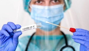 Salud detecta dos casos de coinfección de influenza y Covid-19