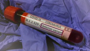 Salud reveló que del total de muestras positivas de la semana pasada, el 90 % pertenece a la variante Ómicron