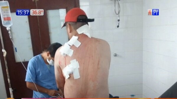 Intento de sicariato en Capitán Bado | Noticias Paraguay
