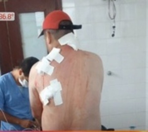 Ciudadano brasileño es atacado a balazos en Capitán Bado  - Paraguay.com