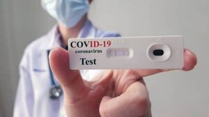 España puso precio fijo a los test de autodiagnóstico de coronavirus
