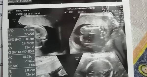 La Nación / El pequeño Lucas, quien lucha por su vida, necesita de la ayuda de todos