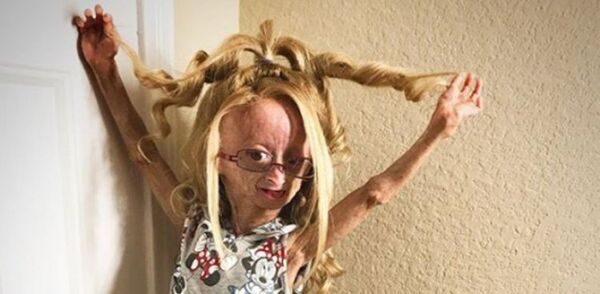 Muere Adalia Rose Williams, la famosa youtuber que inspiró la película de Benjamin Button
