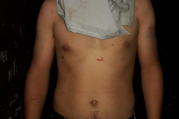 Violento joven golpea y amenaza de muerte a su expareja embarazada