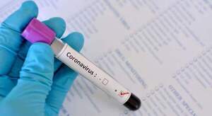 Salud confirma el fallecimiento de nueve personas por el maldito virus