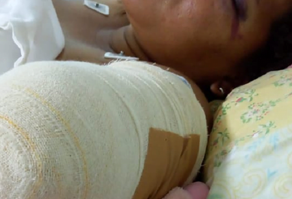Joven queda sin un brazo tras ser arrollada por un automóvil - Noticiero Paraguay