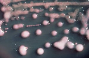 Diario HOY | Describen cómo una mujer superó una infección bacteriana multirresistente